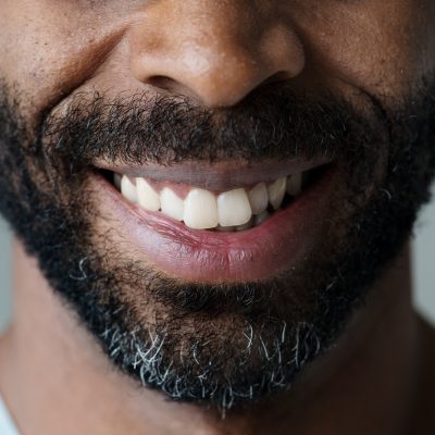 closeup-of-smiling-teeth-of-a-black-man-PG8YT3C